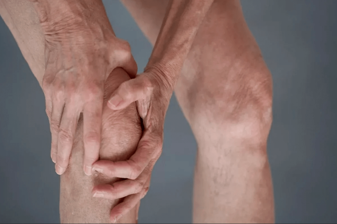 Joint pain can be the cause of osteoarthritis or arthritis