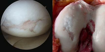 Image of the surface of the knee joint