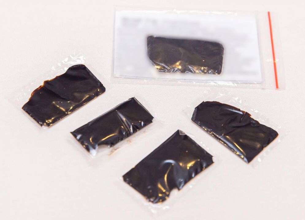 Shilajit is an effective remedy for treating cervical osteochondrosis at home