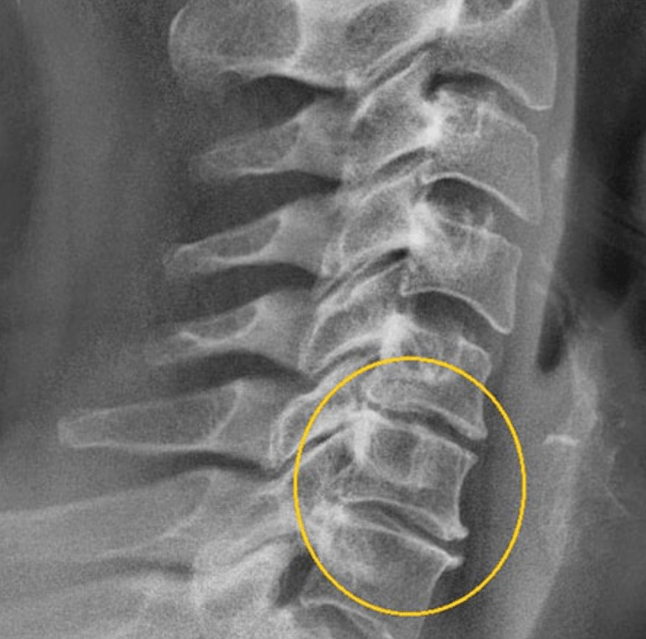 Diagnostic picture