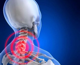 Osteochondrosis-invasive treatment method